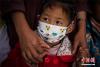 2006年5月，中国红十字基金会倡导设立了救助先心病儿童的专项基金——“天使阳光基金”，以所募善款专项用于救助家庭贫困的先心病儿童。截至2017年底，累计在全国范围内救助贫困先心病患儿9千余名。中新社记者 何蓬磊 摄